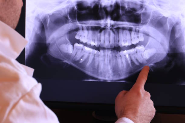 Best Emergency Tooth Extraction in Harrisburg, NC