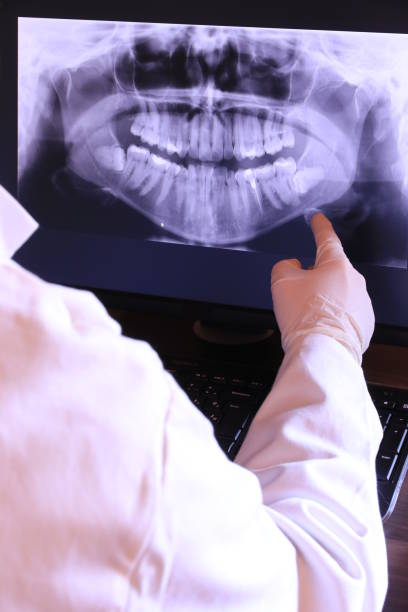 Best Emergency Treatment for Dental Infections or Abscesses in Harrisburg, NC