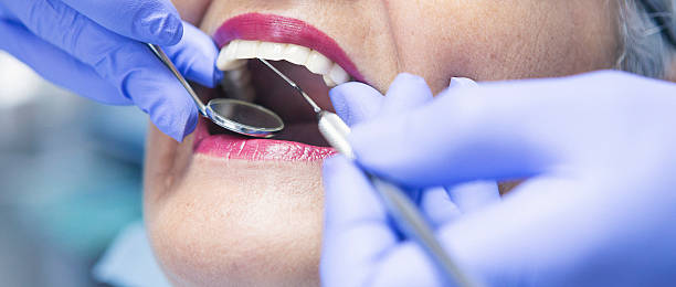 Best Emergency Wisdom Teeth Removal in Harrisburg, NC